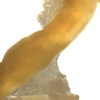 image of duodenum